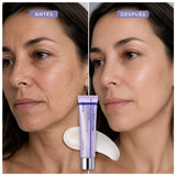 Crema coreana SKIN1004 CENTELLIAN 24 Expert Madeca con PDRN, crema facial para renovación y cuidado de la piel.