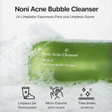 Bote de 155ml de limpiador facial con burbujas Noni de CELIMAX, producto coreano para el cuidado de la piel y el acné