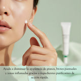 Crema correctora para manchas SKIN1004 Tea-Trica en envase de 20ml, ideal para cuidado facial y reducción de marcas.